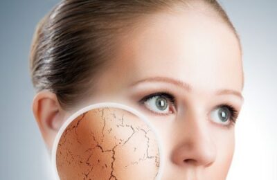 Piele uscată: 5 moduri în care poți remedia această problemă după expunerea la soare