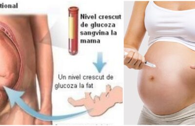 Diabetul gestațional crește cu 40% riscul de refracție oculară la copii