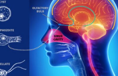 Un copil de 7 ani a murit după ce s-a infectat cu o amibă care se hrănește cu creierul uman