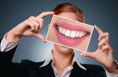 Ce probleme pot fi tratate cu fațetele dentare?