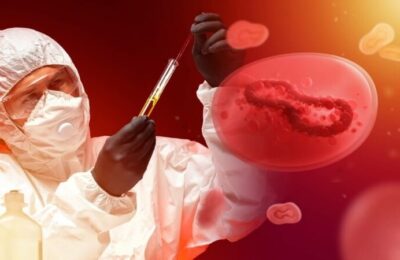 Stare de urgență declarată în California din cauza variolei maimuţei