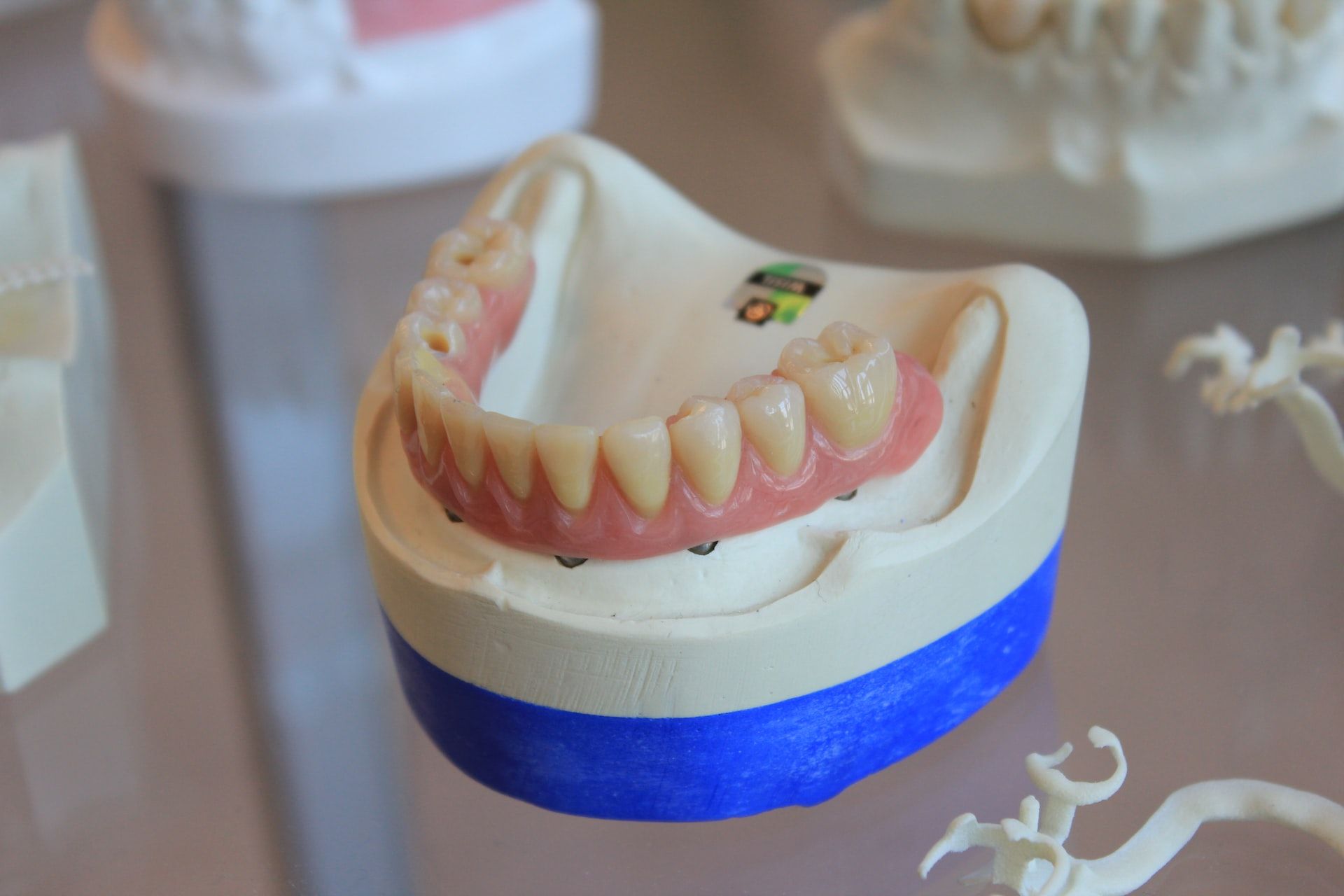 Motive care susţin decizia de a face implant dentar în Bucureşti