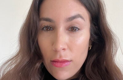 Daxxify funcționează mai bine decât Botox? Am încercat noua neurotoxină.