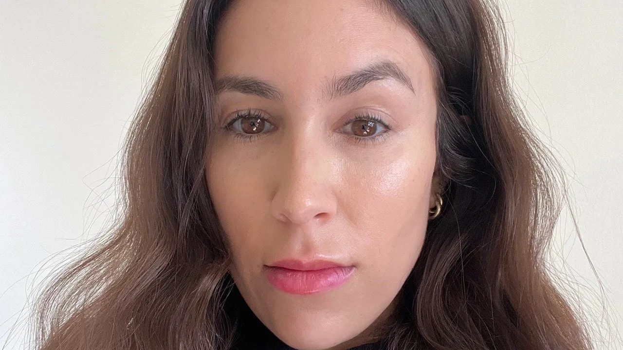 Daxxify funcționează mai bine decât Botox? Am încercat noua neurotoxină.
