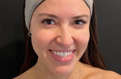 Ce este tratamentul HydraFacial și de ce este atât de popular?