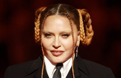 Madonna a împărtășit o fotografie a feței sale acum că „umflăturile de la operație au scăzut” – Vezi foto