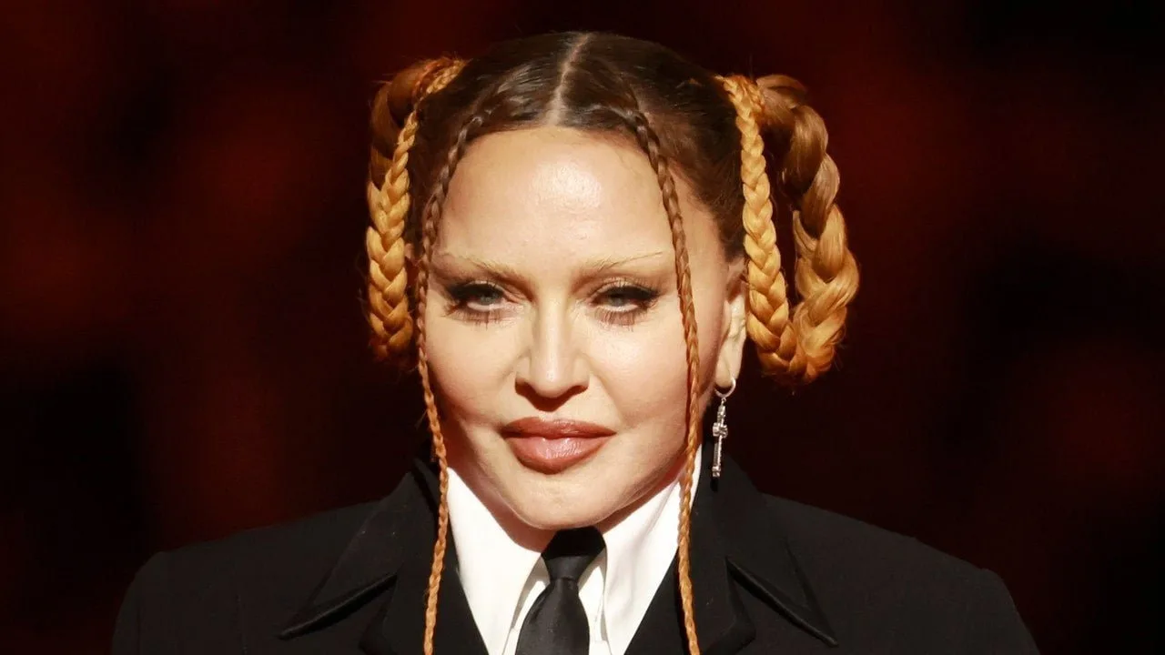 Madonna a împărtășit o fotografie a feței sale acum că „umflăturile de la operație au scăzut” – Vezi foto