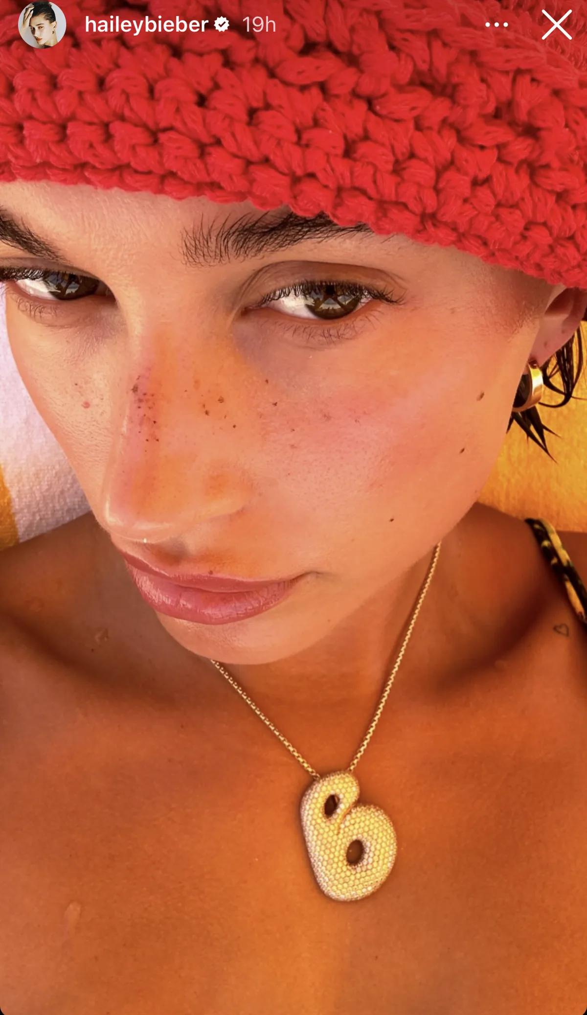 Pistruiții lui Hailey Bieber sunt în prim plan în noile ei poze de pe plajă – Vezi foto