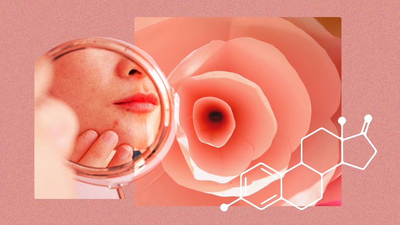 Cum pot afecta hormonii psoriazisul