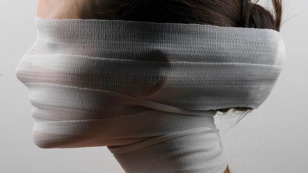 În interiorul epidemiei de chirurgie plastică a fotografiilor dubioase înainte și după