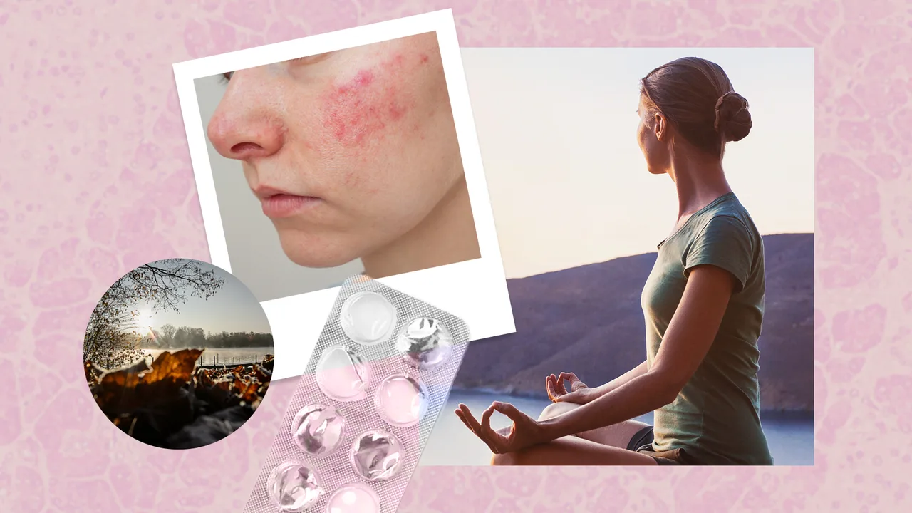 7 factori declanșatori ai psoriazisului pe care toată lumea ar trebui să îi cunoască
