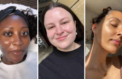 Cele mai bune tratamente faciale din New York, potrivit editorilor Allure