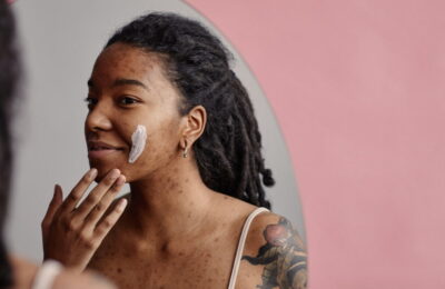 3 tipuri de cicatrici de acnee și cum să le tratezi