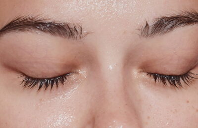 Acid hipocloros pentru piele: Utilizări, beneficii și efecte secundare