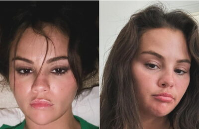Selena Gomez a împărtășit o mulțime de selfie-uri imediat după ce a închis zvonurile privind chirurgia plastică