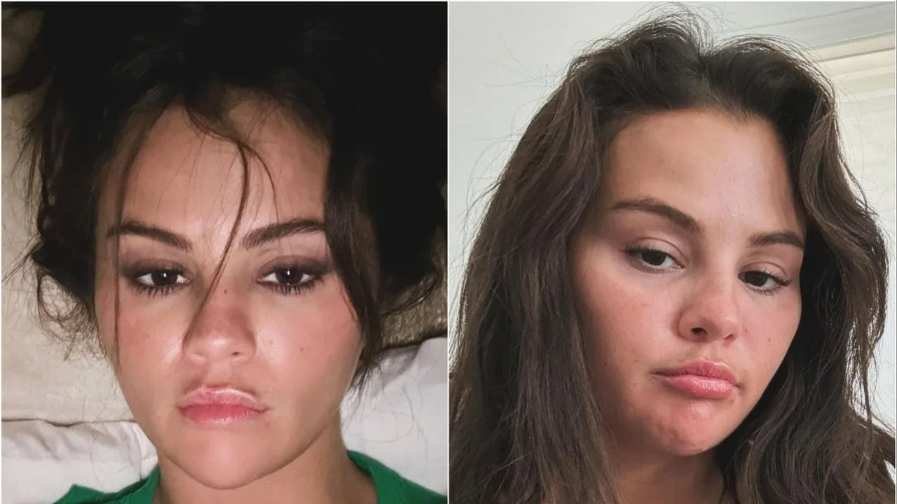 Selena Gomez a împărtășit o mulțime de selfie-uri imediat după ce a închis zvonurile privind chirurgia plastică