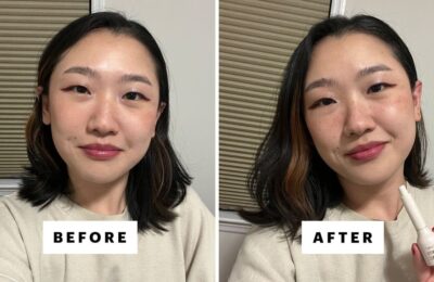 Ai câștigat, TikTok. Pixurile pentru pistrui sunt un must-have