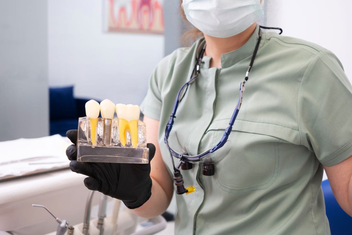 Factori determinanți ai costului unui implant dentar