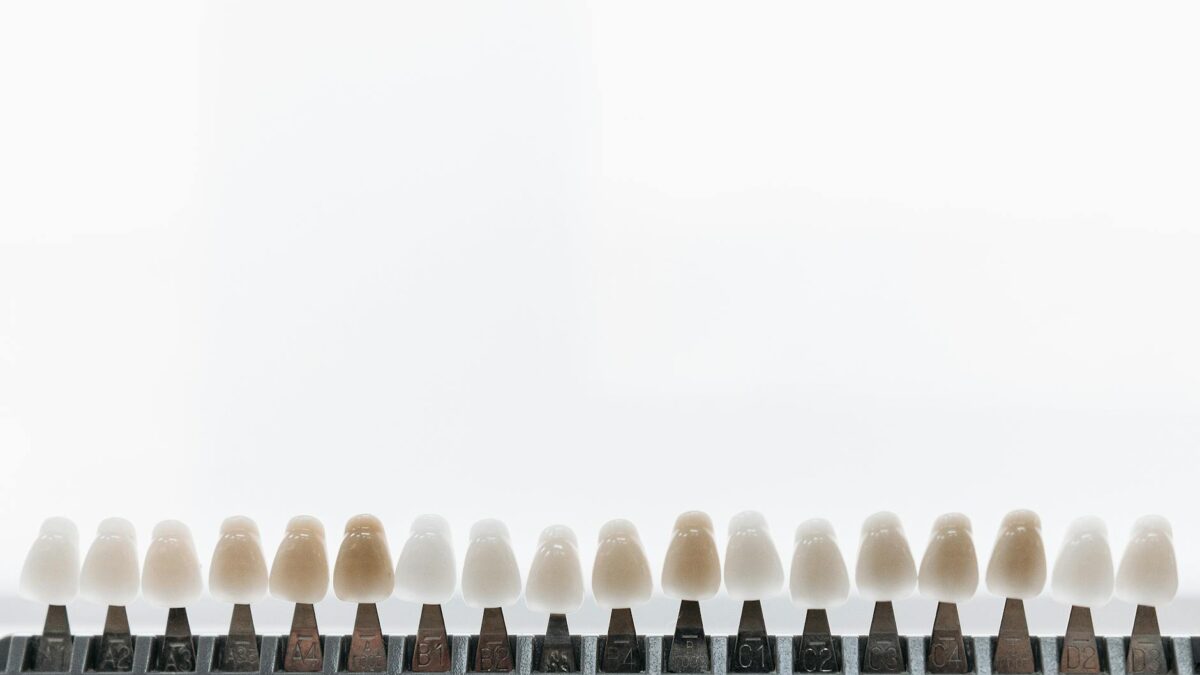 Chrissy Teigen își pierde fațetele dentare într-un accident