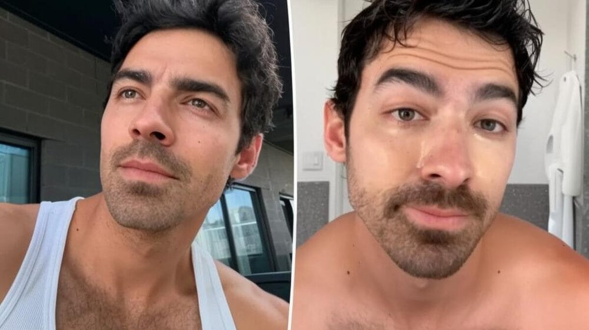 Joe Jonas plasturi ochi