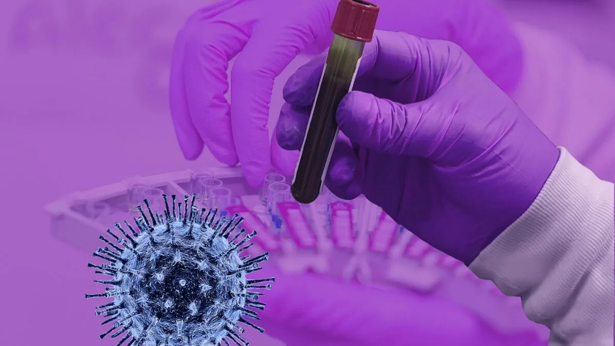 epidemie rujeolă