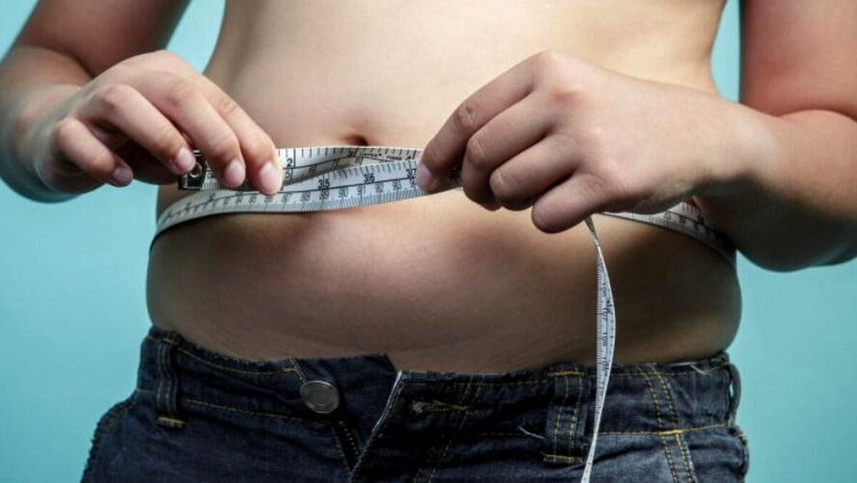 Aproape 40% dintre adulții români sunt obezi. O operație ar putea fi decontată din toamnă