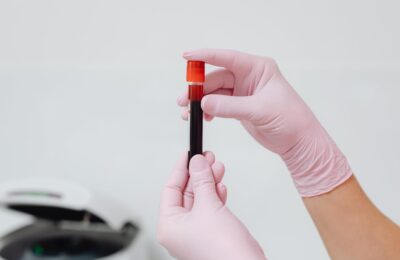 Importanța monitorizării sănătății metabolice în ritmul alert al vieții moderne