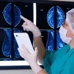 Factorul ignorat care aproape dublează riscul de cancer la sân la 40% din femei