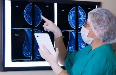 Factorul ignorat care aproape dublează riscul de cancer la sân la 40% din femei