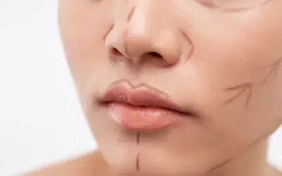 Colegiul Medicilor a demarat o anchetă, după moartea femeii de 45 de ani, în cadrul uni lifting facial