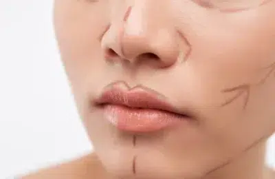 Colegiul Medicilor a demarat o anchetă, după moartea femeii de 45 de ani, în cadrul uni lifting facial