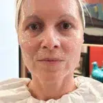 Liftingul facial de 4.000 de lire care promite rezultate fără bisturiu