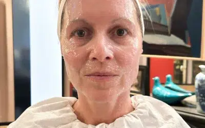 Liftingul facial de 4.000 de lire care promite rezultate fără bisturiu