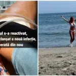 Avocata din Galati avertizeaza femeile dupa 30 de operatii. Gelul Aquafilling provoaca infectii