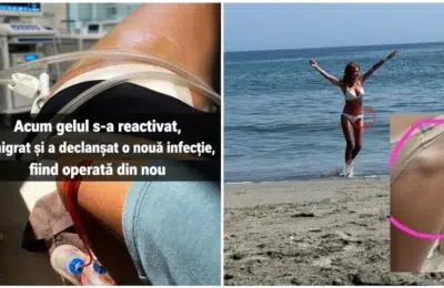Avocata din Galati avertizeaza femeile dupa 30 de operatii. Gelul Aquafilling provoaca infectii