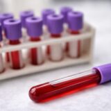 West Nile România, România e a treia țară din Europa ca regiuni afectate de West Nile. Ce e în joc pentru vârstnici și