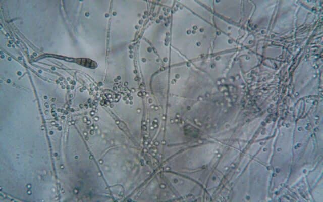 Filamente și spori fungici microscopici