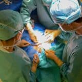 Inimi transplantate în timpul intervenției