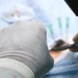 Intervenție chirurgicală de transplant cardiac