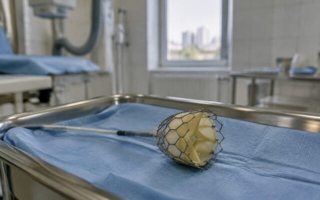 O valvă tricuspidă